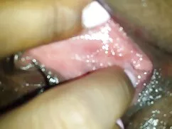ফিসনেট ম্যাসেজ ধূমপা ...